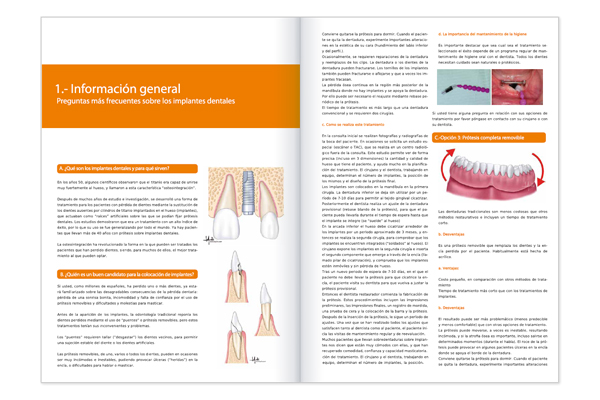 Guía de pacientes de implantes dentales clínica Baladrón